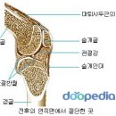 슬개골 연골 연화증 이미지