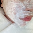 속편한김내과의원 | 청담루틴의원 15년 전문의 병원| BBL레이저, 모공주사 리얼 후기