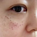 준메디컬 | 스페셜토닝 3회차