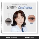 박선희속눈썹