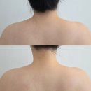 다온 | 옥정웨딩윤곽관리 스파다온 후기 시그니처 윤곽 받고 얼굴 라인 진짜 바뀜