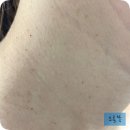 영드림의원 네이버블로그