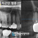 서울바정치과의원 이미지