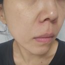 로하스약국 | 닥터비타 프리미엄C크림, 프리미엄 마스크팩 후기