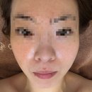 폭탄머리 - 전주시 덕진구 | [부산 금정구 에스테틱] 올리다 에스테틱 | 여름철 속건조 채워주는 수분폭탄관리 후기