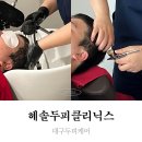 이디야대구범어경신점 | 대구두피케어 헤솔 두피 탈모 범어점 ,트러블 뉴트리맥스 문제성 두피관리 받고 온 후기