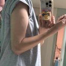(주) 포스트핀스페이스 | 팔꿈치 주두돌기 골절 핀 제거 수술 2~3주차 / 봉합완료 도수치료 시작 (팔꿈치 각도)