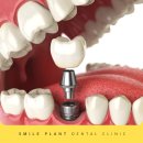 중원치과기공소 이미지