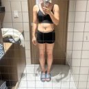 반디(주)대전지점 | 대전다이어트병원 | 허벅지 뱃살 지방분해주사 후기