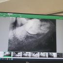고운미소 | 수유 연세고운미소치과 정기검진+교정상담+ 스케일링 후기