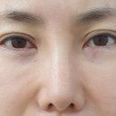 미션클리어 이미지