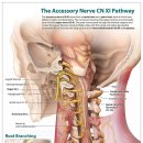 Re: 9, 10, 11, 12 cranial nerve 질환... 이미지