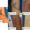 리뉴미피부과의원 이미지