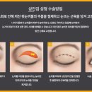 바나나성형외과의원 이미지