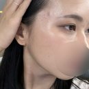 캄에스테틱 | [일산 캄에스테틱] 오랜만에 돌아온 재후기✨ 여드름 수분 관리 피부샵 추천, 카뮬라 화장품 찐후기