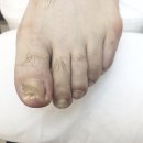 세븐일레븐 화성반송중앙점 | 동탄 발관리, 문제성발관리 전문샵 솔직후기 레푸스동탄반송점