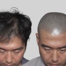 꽉찬두피