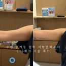 올바른한의원 | 수원 인계동 한의원 지방분해주사 1~5회차 팔뚝 신부관리 솔직 후기