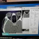 (주)인지메디칼 이미지