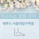 레푸스MS 네이버블로그