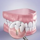 연세덴티프로치과의원 이미지