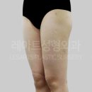 레아트성형외과의원 이미지