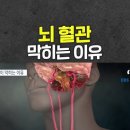 [우한폐렴] 뇌경색 심근경색 다 백신 때문인데 왜 자꾸 이미지