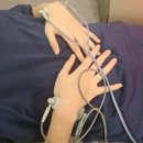 양성한의원 | 손목 터널 증후군 초기 증상 및 한의원 침 맞고 온 후기