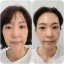 마산재생관리 에스테티아 창원신세계점 더마리젠 리턴 솔루션 케어 물광관리 후기