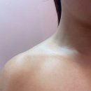 문스뷰티플러스 | 구미 라운드숄더 해결 문스뷰티플러스 추천