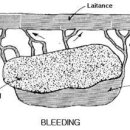 블리딩이란? 이미지