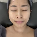울산 송정 피부관리 히엘에스테틱 트러블흔적 mts 관리 후기