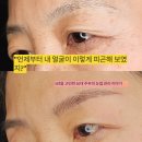 황성수치과의원 | 진해자은동눈썹관리, 50대 주부가 3년 고민 끝에 선택한 이유