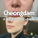 시크릿 | 청담피부과 모공축소시술 늘어진 모공, 여드름 흉터 bye 시크릿레이저+쥬베룩 후기