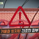 [닥터의 경고, 피부 건조] 트고, 갈라지고, 가려운 피부 피부 건조로 인한 결과! 아토피, 건선 등 여러 질환이 생기기 쉬운... 이미지