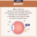 수원가톨릭약국 | [약사가 알려주는] 눈 영양제 끝판왕 출시! 눈 건강에 좋은 영양소 총집합된 눈영양제 밸런스 눈건강 소개