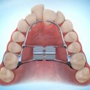 휴플란트치과의원 이미지