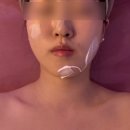 르보뷰티 | 성북구 피부관리샵 ‘리리뷰티뷰티끄 성신여대점’ 수분피지관리 후기