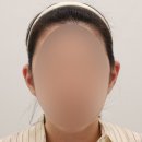 더미인의원 | 미인 귀 필러 잘하는 곳? 대표원장인 저는 이렇게 합니다.