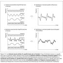 Chapter 17. Acupressure Formatting Acupressure format waveform analogy 이미지
