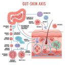 큐아크네 플러스 연고 내돈내산 후기 좁쌀 화농성 효과
