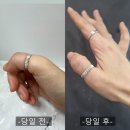 얼굴붓기 관리는 붓기보조제 다이톡스 리베인정 후기