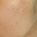 스킨룩스한의원 이미지