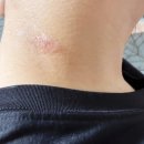 현대의원 | 대전 관평동 피부과 현대365의원 후기