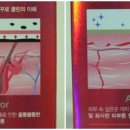 이노클린