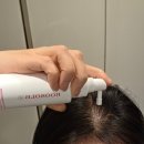 카페로티아 | 정수리 초기 탈모 시작됐다면? 비오티아 리볼좀토닉 사용후기