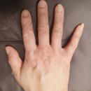 하늘메디칼 이미지