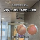 김포한강 4로 | 김포굳은살 레푸스 김포 한강신도시점 발바닥 통증 사라진 후기