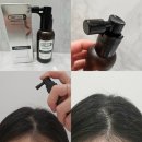 동전탈모 해결템? 셀로니아 NGF 574 에이치 헤어토닉 리얼후기