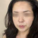 정릉49 | 정릉역 라비앙제이뷰티 라인축소경락 후기🌿 탄력주름 / 시조피린니들 / 여드름모공 / 로즈필링 / 피부...